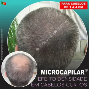 <b>Microcapilar® Efeito Densidade em Cabelos Curtos (de 1 a 4 cm)</b>