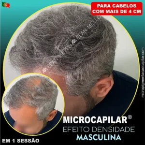 <b>Microcapilar® Efeito Densidade</b> - Masculina