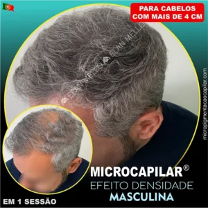 <b>Microcapilar® Efeito Densidade</b> - Masculina