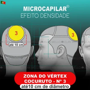 Zona do Vértex / Cocuruto - até 10 cm de diâmetro - nº 3 - Microcapilar® Efeito Densidade
