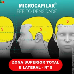 Zona Superior Total e Lateral - nº 5 - Microcapilar® Efeito Densidade