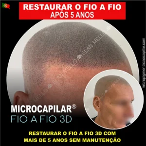 Serviço para Restaurar o Fio a Fio 3D com mais de 5 Anos sem manutenção