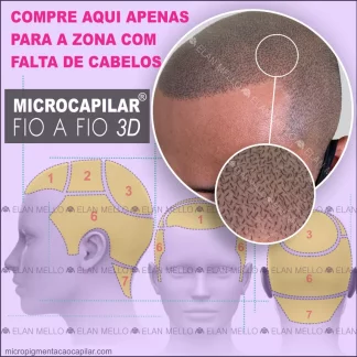COMPRAR POR ZONA - FIO A FIO 3D - MICROCAPILAR®