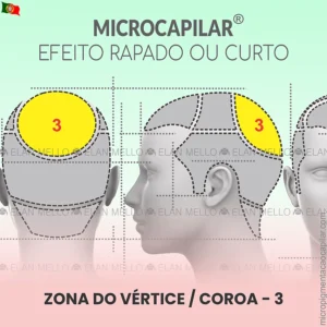 Zona do Vértice / Coroa - n.º 3 - Microcapilar® Efeito Cabelo Rapado ou Curto