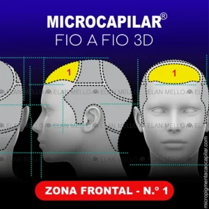 Zona Frontal – n.º 1 – Microcapilar® Fio a Fio 3D
