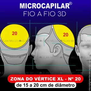 Zona do Vértice de 15 a 20 cm de diâmetro - n.º 20 – Microcapilar® Fio a Fio 3D