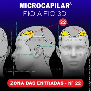Zona das Entradas – n.º 22 – Microcapilar® Fio a Fio 3D